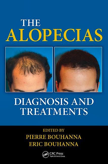 Portada del libro 9781482212754 The Alopecias. Diagnosis and Treatments