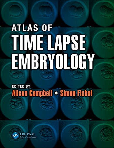 Portada del libro 9781482214468 Atlas of Time Lapse Embryology