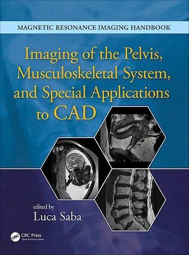 Portada del libro 9781482216219 Magnetic Resonance Imaging Handbook. Imaging of the Pelvis, Musculoskeletal System, and Special Applications to Cad