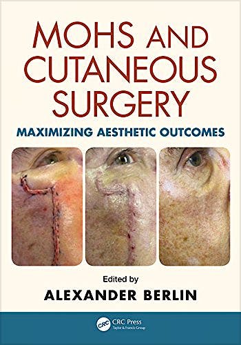 Portada del libro 9781482221367 Mohs and Cutaneous Surgery. Maximizing Aesthetic Outcomes