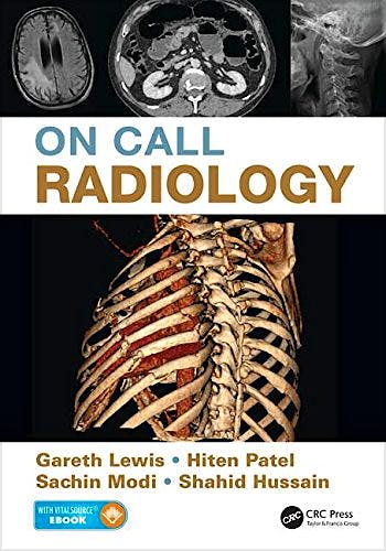 Portada del libro 9781482221671 On Call Radiology