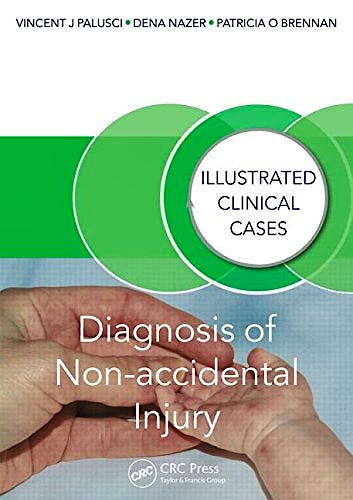 Portada del libro 9781482230130 Diagnosis of Non-Accidental Injury. Illustrated Clinical Cases