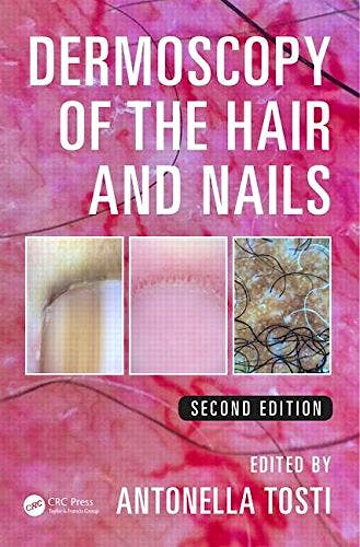 Portada del libro 9781482234053 Dermoscopy of the Hair and Nails