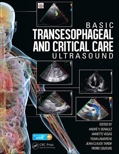 Portada del libro 9781482237122 Basic Transesophageal and Critical Care Ultrasound