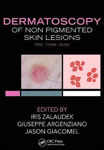 Portada del libro 9781482237528 Dermatoscopy of Non-Pigmented Skin Tumors. Pink - Think - Blink