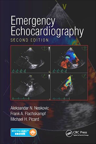 Portada del libro 9781482243857 Emergency Echocardiography