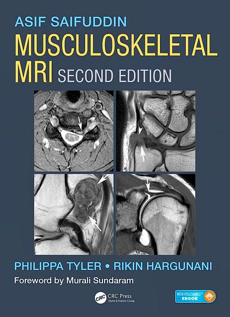 Portada del libro 9781482247800 Musculoskeletal MRI (book + ebook)