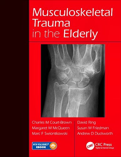 Portada del libro 9781482252026 Musculoskeletal Trauma in the Elderly
