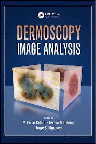 Portada del libro 9781482253269 Dermoscopy Image Analysis