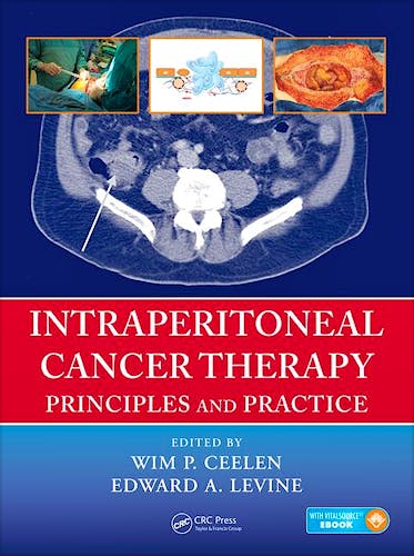 Portada del libro 9781482261189 Intraperitoneal Cancer Therapy. Principles and Practice