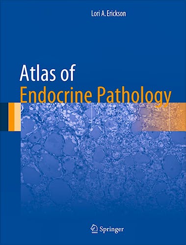 Portada del libro 9781493904426 Atlas of Endocrine Pathology