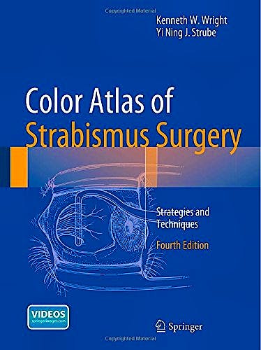 Portada del libro 9781493914791 Color Atlas of Strabismus Surgery. Strategies and Techniques (Hardcover)