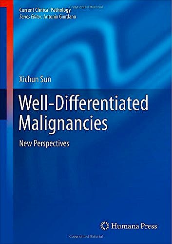 Portada del libro 9781493916917 Well-Differentiated Malignancies. New Perspectives