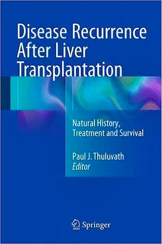 Portada del libro 9781493929467 Disease Recurrence after Liver Transplantation. Natural History, Treatment and Survival