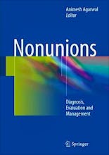 Nonunions. Diagnosis, Evaluation and Management