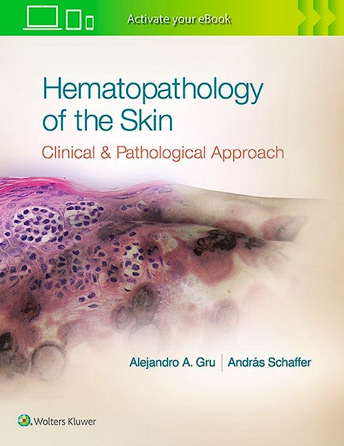 Portada del libro 9781496300584 Hematopathology of the Skin. A Clinical and Pathologic Approach