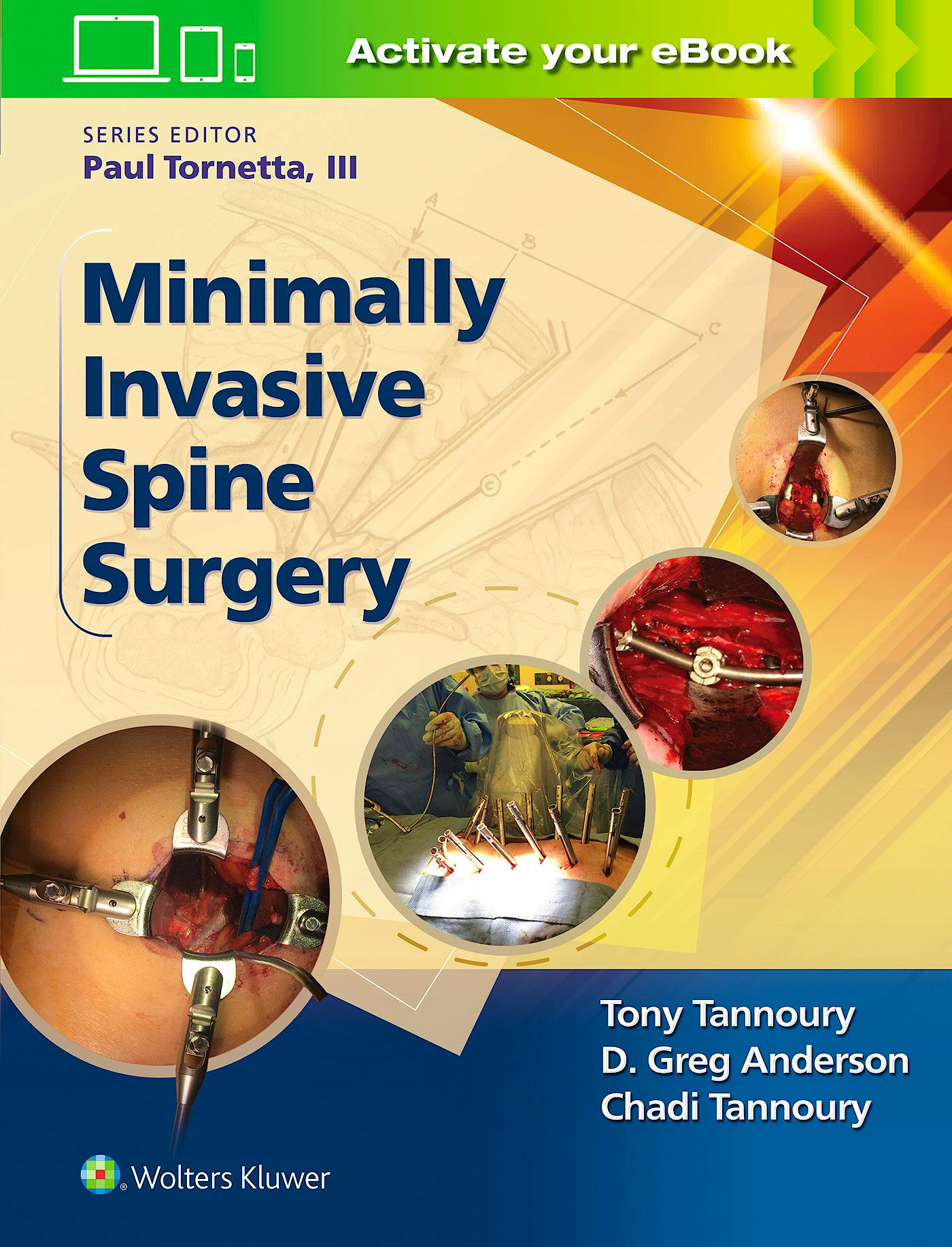 Portada del libro 9781496301321 Minimally Invasive Spine Surgery