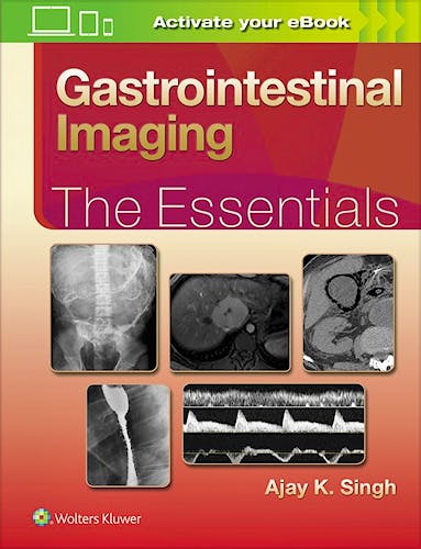 Portada del libro 9781496307194 Gastrointestinal Imaging: The Essentials
