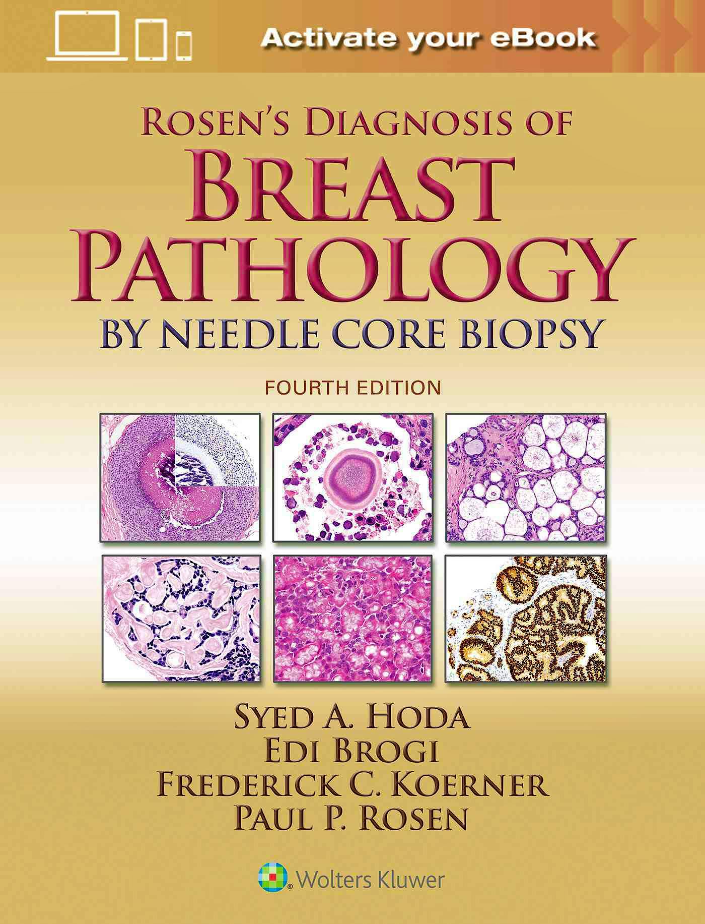 Portada del libro 9781496307255 Rosen's Diagnosis of Breast Pathology by Needle Core Biopsy