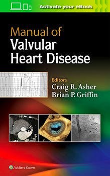 Portada del libro 9781496310125 Manual of Valvular Heart Disease