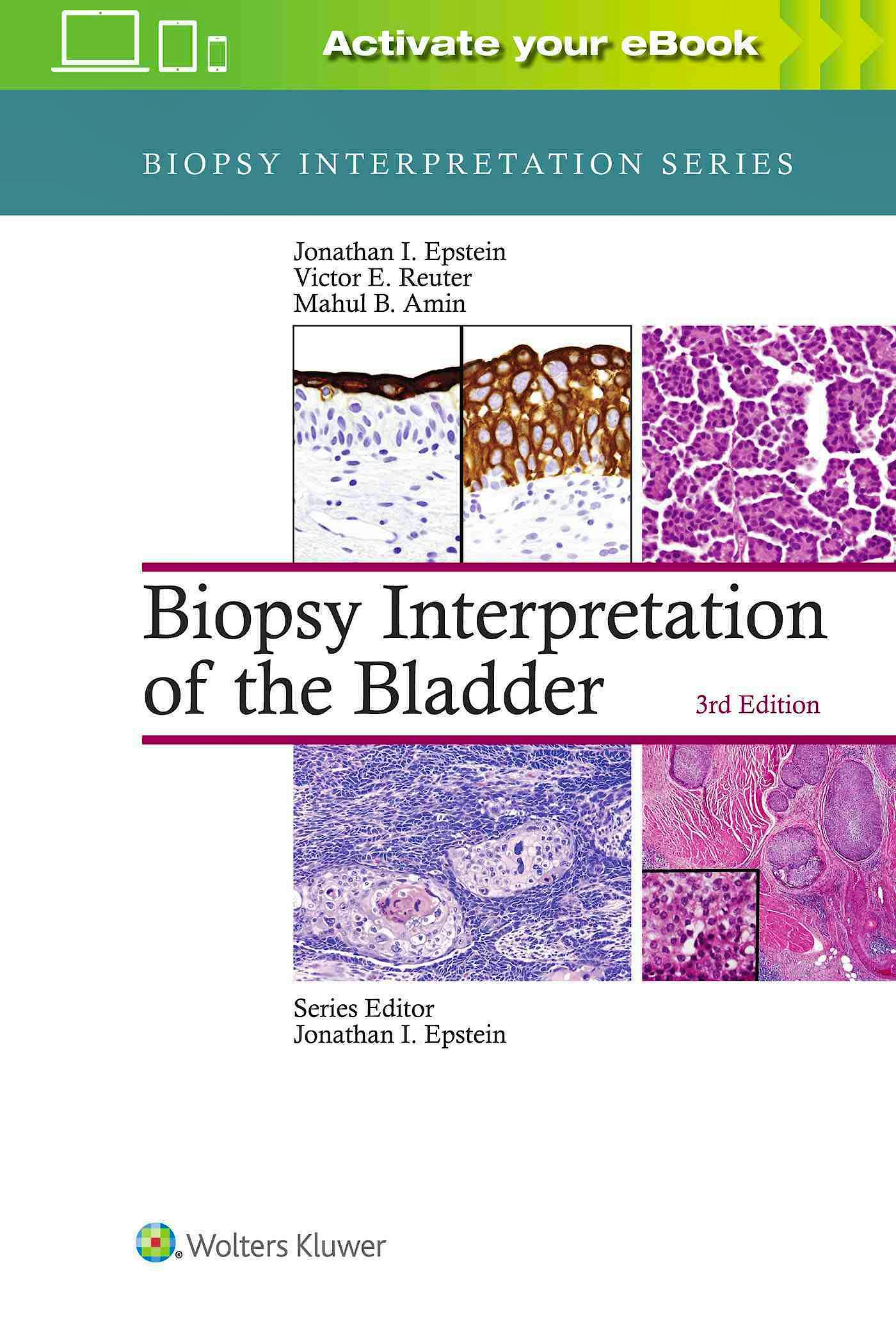 Biopsy Interpretation Of The Bladder 9781496315045 Epstein J