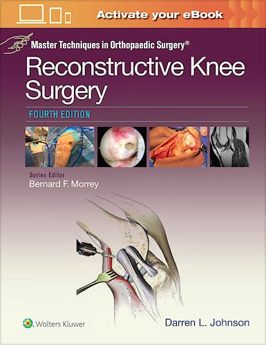Portada del libro 9781496318275 Master Techniques in Orthopaedic Surgery. Reconstructive Knee Surgery