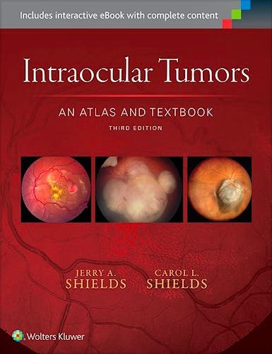 Portada del libro 9781496321343 Intraocular Tumors. An Atlas and Textbook