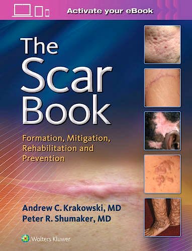 Portada del libro 9781496322388 The Scar Book. Scar Formation, Rehabilitation, and Prevention