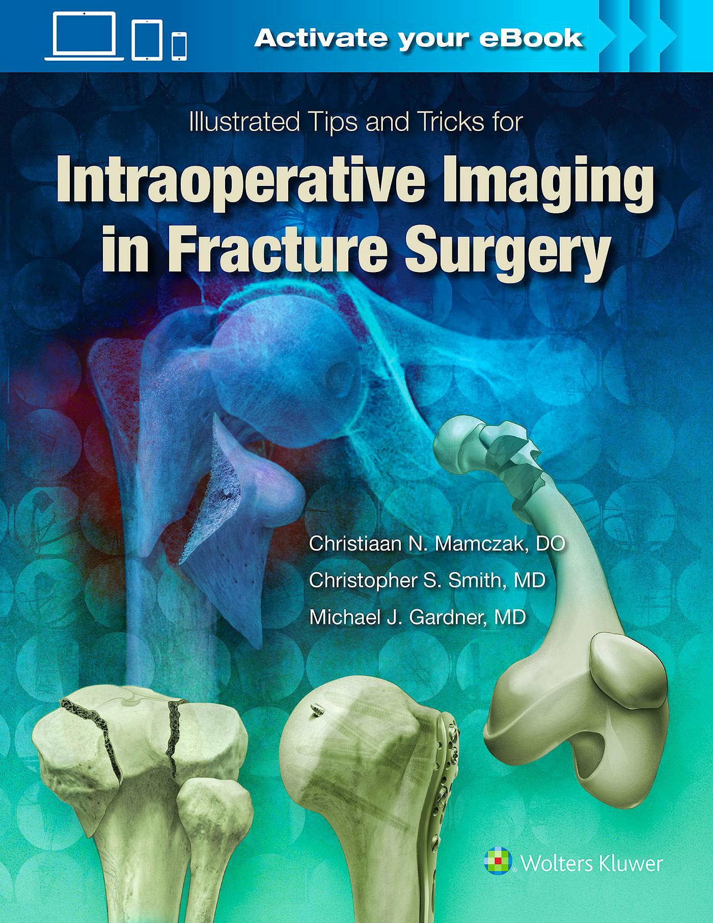 Portada del libro 9781496328960 Illustrated Tips and Tricks for Intraoperative Imaging in Fracture Surgery
