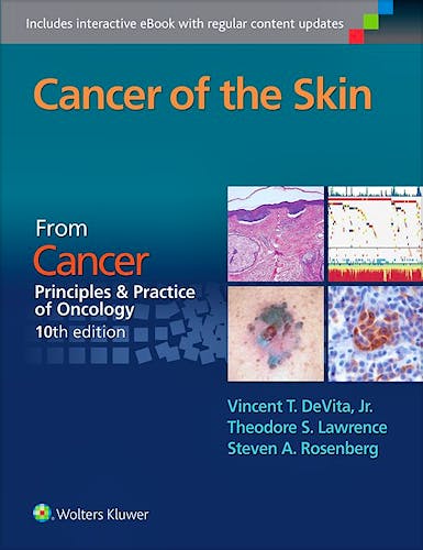 Portada del libro 9781496333933 Cancer of the Skin (From Cancer Principles and Practice of Oncology, 10th Edition)