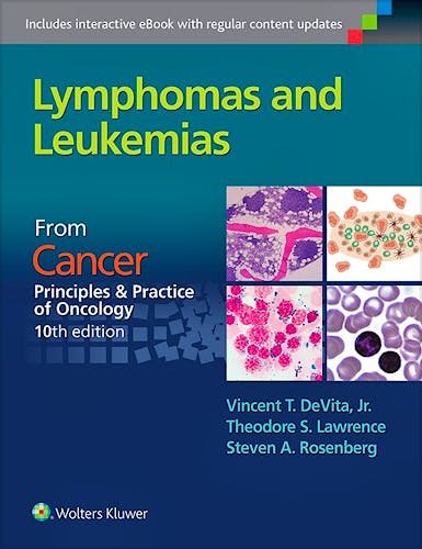 Portada del libro 9781496333940 Lymphomas and Leukemias (From Cancer Principles and Practice of Oncology, 10th Edition)
