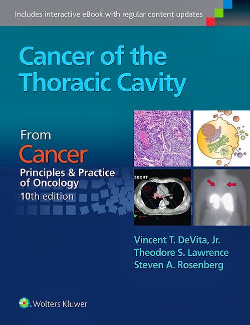 Portada del libro 9781496333957 Cancer of the Thoracic Cavity (From Cancer Principles and Practice of Oncology, 10th Edition)