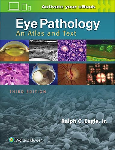 Portada del libro 9781496337177 Eye Pathology. An Atlas and Text