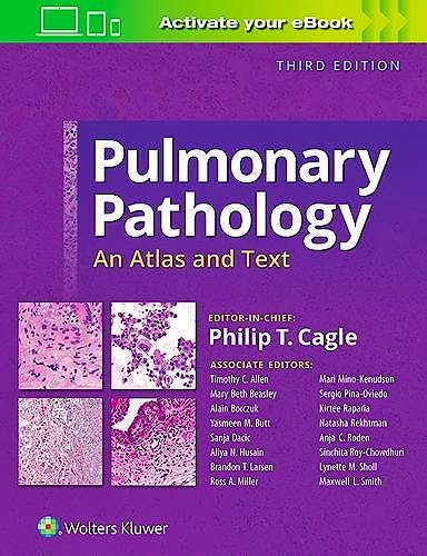 Pulmonary Pathology. An Atlas and Text: 9781496346094: Cagle, P. | axon.es