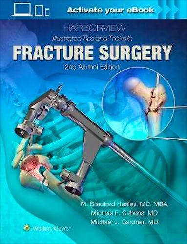 Portada del libro 9781496355980 Harborview Illustrated Tips and Tricks in Fracture Surgery
