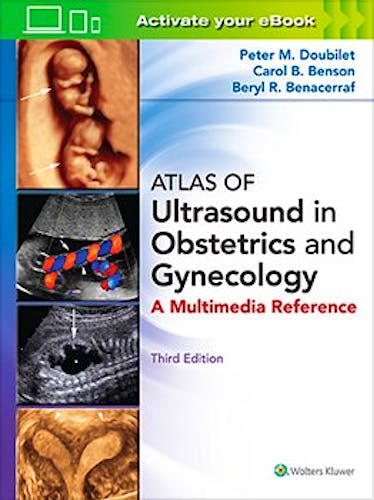 Portada del libro 9781496356055 Atlas of Ultrasound in Obstetrics and Gynecology