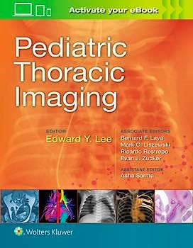 Portada del libro 9781496356239 Pediatric Thoracic Imaging