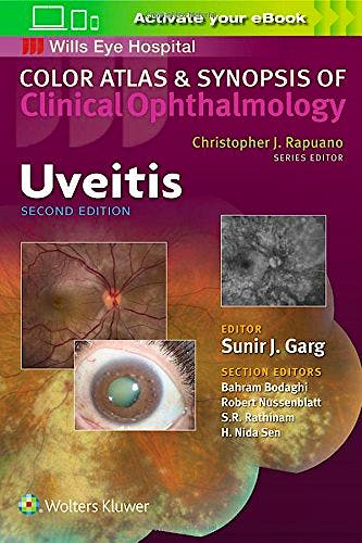 Portada del libro 9781496363008 Uveitis (Color Atlas and Synopsis of Clinical Ophthalmology. Wills Eye Hospital)