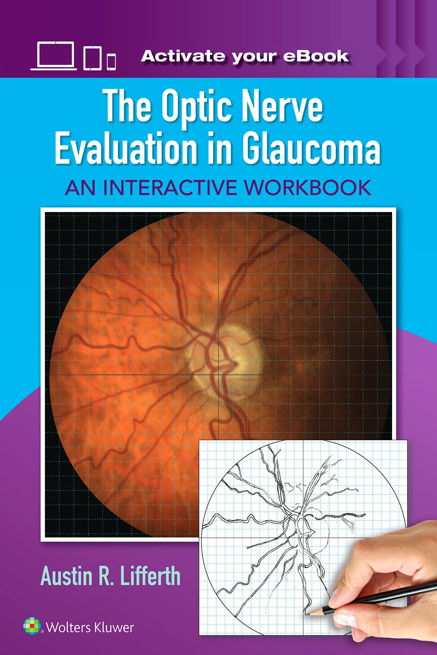 Portada del libro 9781496363138 The Optic Nerve Evaluation in Glaucoma. An Interactive Workbook