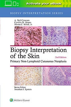 Portada del libro 9781496365132 Biopsy Interpretation of the Skin. Primary Non-Lymphoid Cutaneous Neoplasia