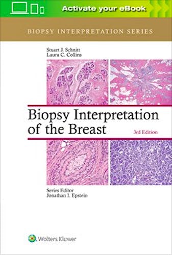 Portada del libro 9781496365750 Biopsy Interpretation of the Breast