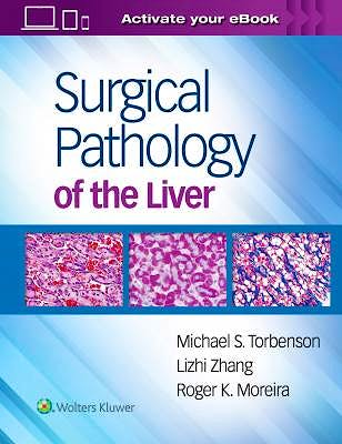 Portada del libro 9781496365798 Surgical Pathology of the Liver (Print and Online)