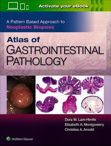 Portada del libro 9781496367549 Atlas of Gastrointestinal Pathology. A Pattern Based Approach to Neoplastic Biopsies