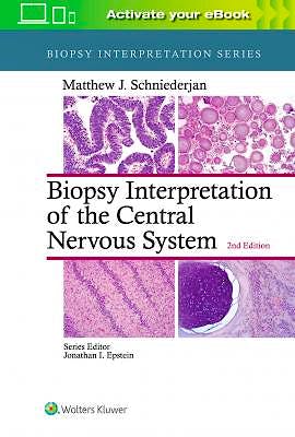 Portada del libro 9781496382634 Biopsy Interpretation of the Central Nervous System