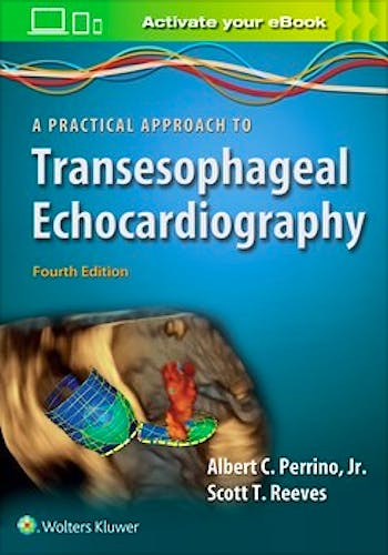 A Practical Approach to Transesophageal Echocardiography