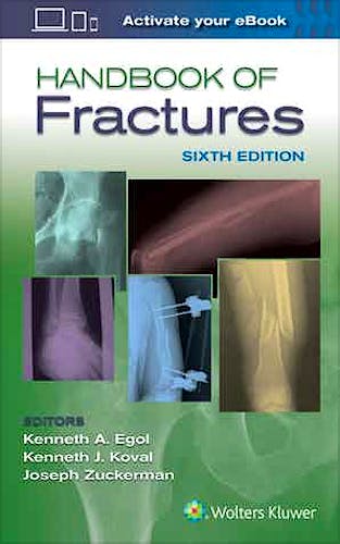 Portada del libro 9781496384850 Handbook of Fractures