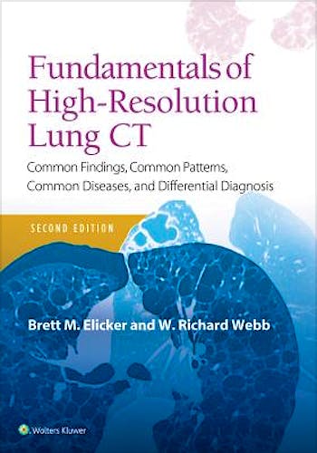 Portada del libro 9781496389923 Fundamentals of High-Resolution Lung CT. Common Findings, Common Patterns, Common Diseases and Differential Diagnosis