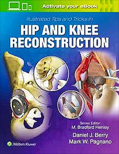 Portada del libro 9781496392060 Illustrated Tips and Tricks in Hip and Knee Reconstructive and Replacement Surgery