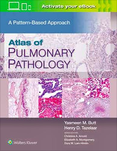 Portada del libro 9781496397553 Atlas of Pulmonary Pathology. A Pattern-Based Approach