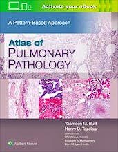 Atlas of Pulmonary Pathology. A Pattern-Based Approach